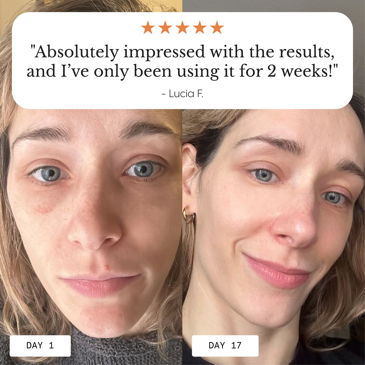 Hyper Potent Dark Circles & Bag Eye Balm